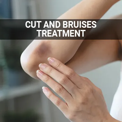 Visit our Cut and Bruise Treatment page